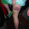 more of robs leg